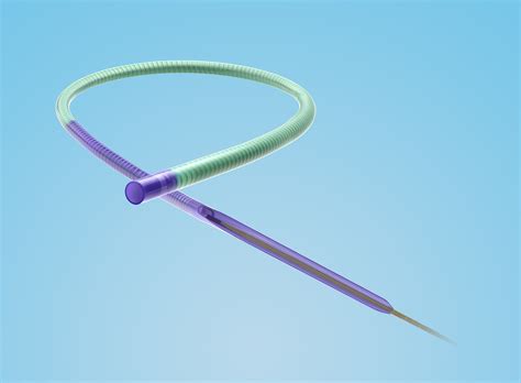 Improving Outcomes for Patients with the Magic Intermetreent Catheter